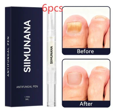 Antifungal pen for toenail care with before and after treatment comparison photos