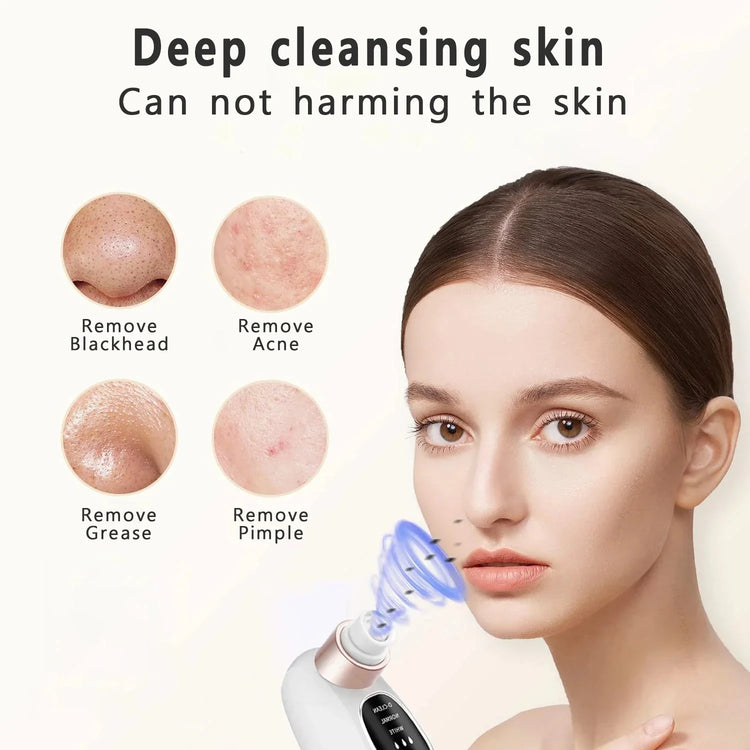 Woman using white pore vacuum for deep facial cleansing, removing blackheads and acne, smooth skin