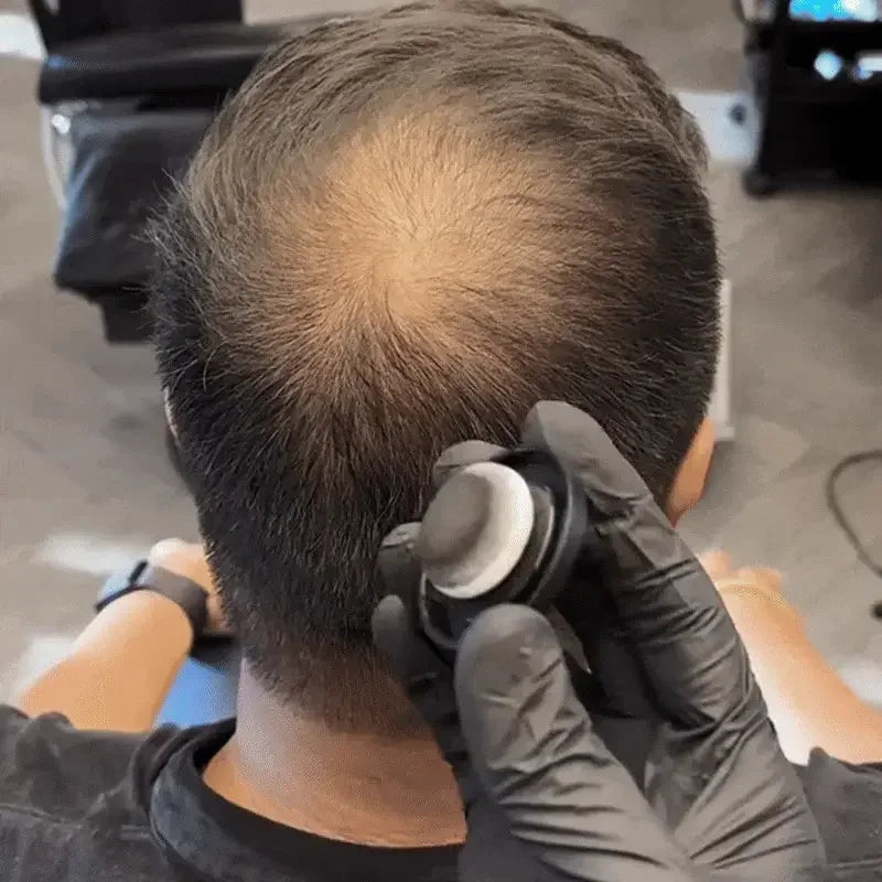 Gloved hand applying hair fiber applicator to thinning hair on man's scalp