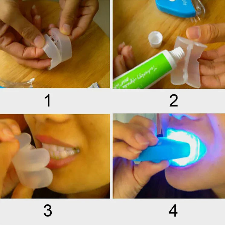 Step-by-step teeth whitening kit instructions with clear mouth tray and blue LED light