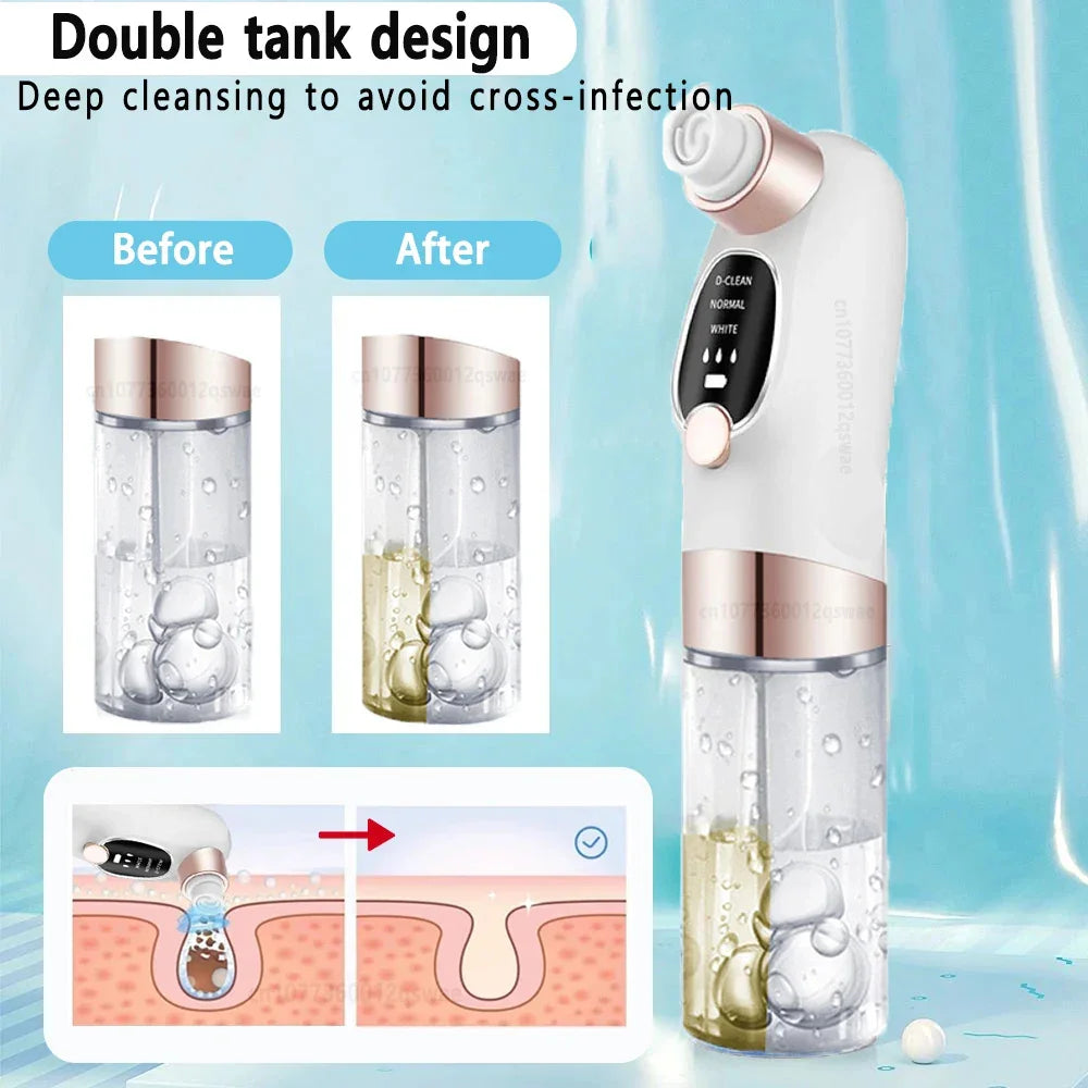 Double tank facial cleansing device with white and gold design, demonstrating deep pore cleaning and skin purification features.