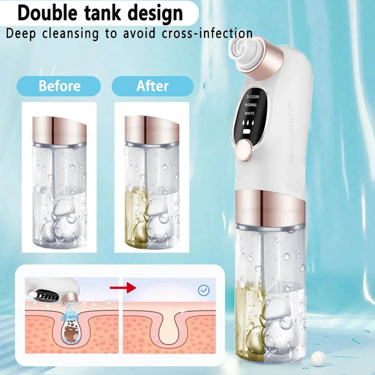 Double tank facial cleansing device with white and gold design, demonstrating deep pore cleaning and skin purification features.