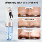Electric pore vacuum device with water tank, before and after results for cleaner skin, smaller pores, and reduced blackheads