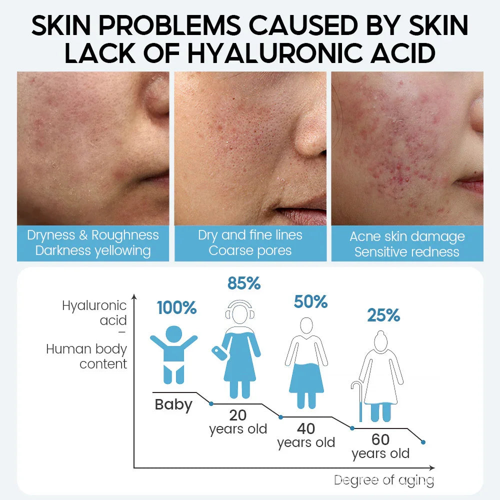 Close-up images of skin with dryness, fine lines, and acne, highlighting hyaluronic acid loss effects.