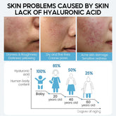 Close-up images of skin with dryness, fine lines, and acne, highlighting hyaluronic acid loss effects.