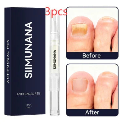 Antifungal nail pen with before and after photos showing improved toenail appearance