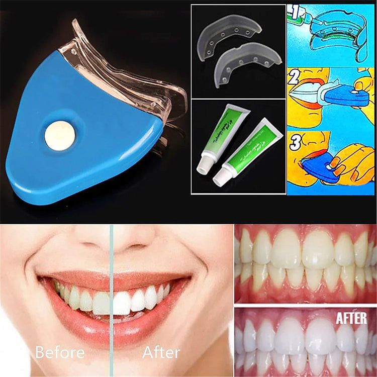 Teeth whitening kit with mouth trays, gel tubes, user instructions, and before-after smile results